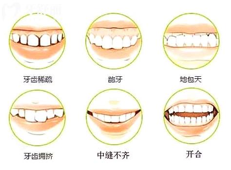 口腔牙周黏膜病科是什么意im·电竞思